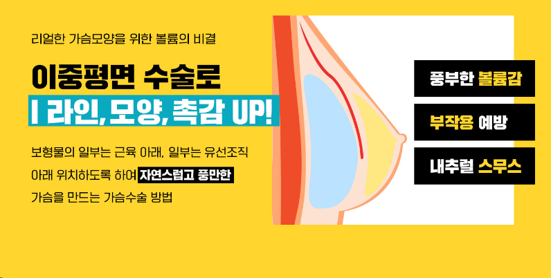 韩国波轮美整形隆胸图